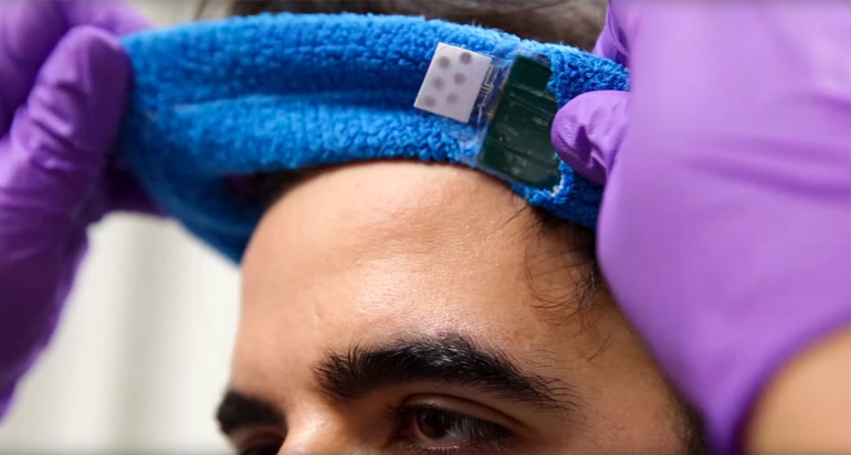 Berkeley uudne sensor analüüsib sinu higi koostist